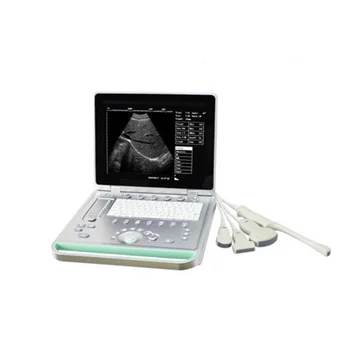 Медицинский Ультразвуковой аппарат для ноутбука UItrasound Instruments Ч/Б Портативный ультразвуковой сканер